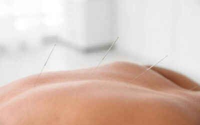 Arthritis: What It Is and How Physiotherapy Can Help